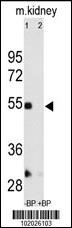 MMP12 Antibody