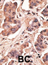 MAGEH1 Antibody