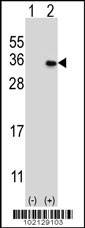 MAGEH1 Antibody