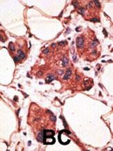 MAGEA9 Antibody