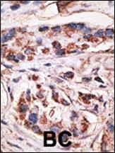 MAGEA1 Antibody