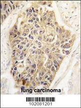 MAGEA1 Antibody