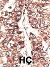 MAGEA11 Antibody