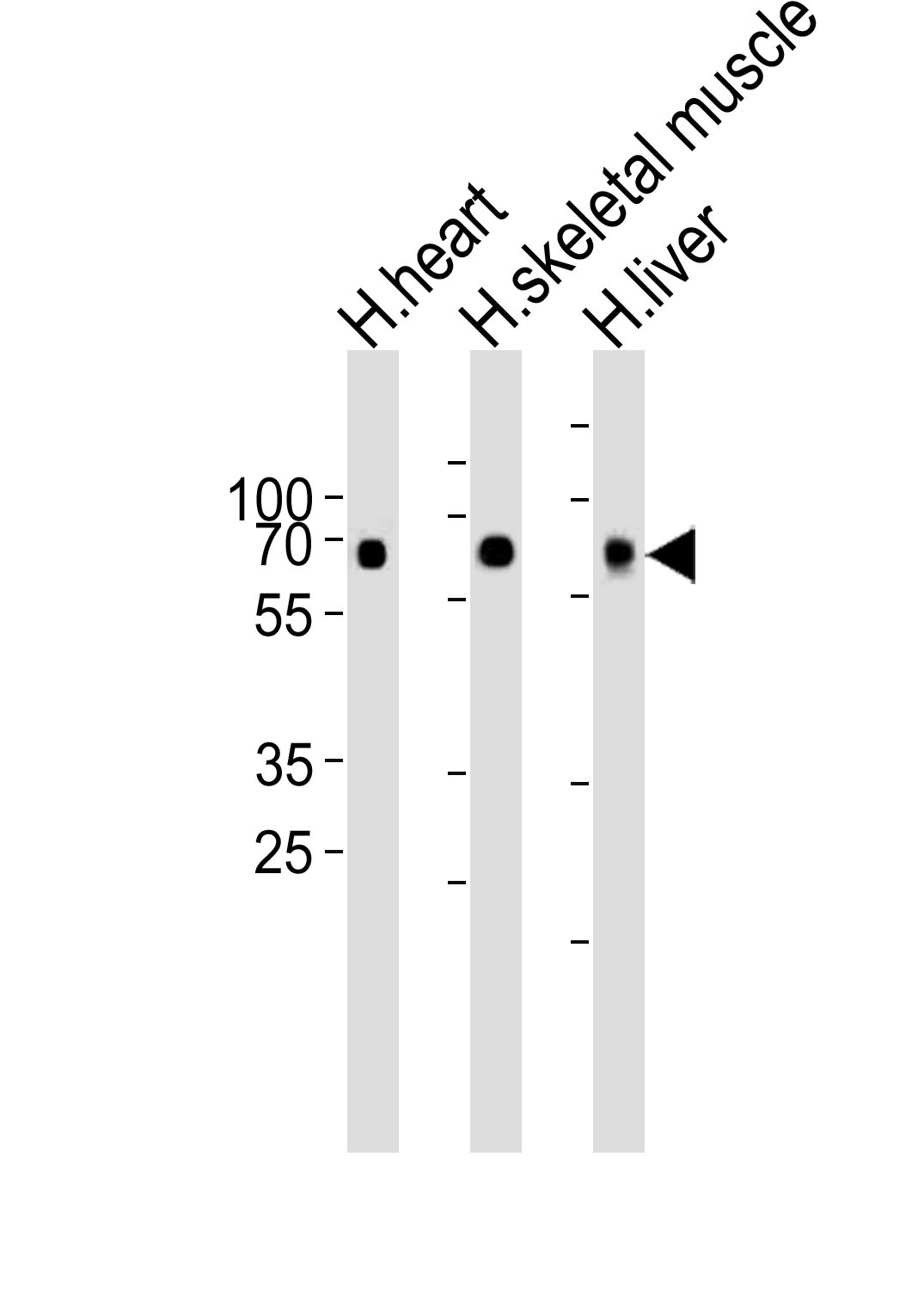 CRY2 Antibody