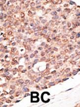Cry2 Antibody