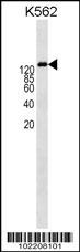 ABCB1 Antibody