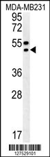 TRAM2 Antibody