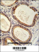 TRAM2 Antibody