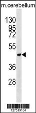 DDX47 Antibody