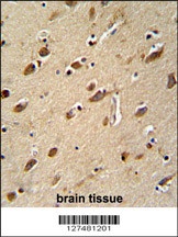 MYLK4 Antibody