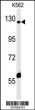 IQSEC3 Antibody