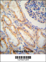 SHISA2 Antibody