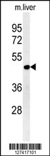 DDI2 Antibody