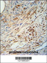 KIF9 Antibody