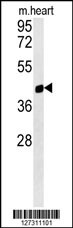 PTGR1 Antibody