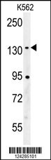 CILP2 Antibody