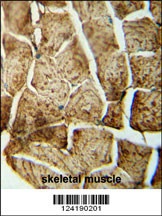 SMPD4 Antibody