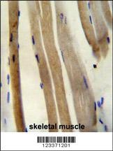 CS Antibody