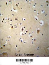 SIAH2 Antibody