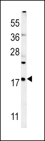 VAMP4 Antibody