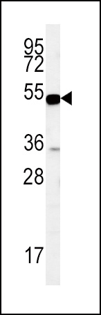 SLC9A3R1 Antibody