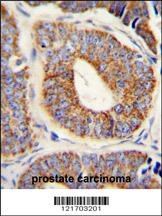 DNAJA1 Antibody