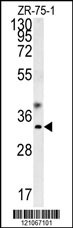 GCH1 Antibody