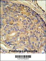 LOH12CR1 Antibody