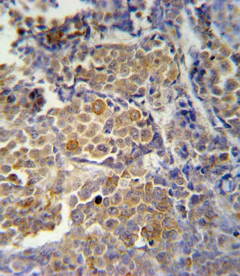 KIR2DS2 Antibody