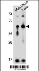 KIR2DL2 Antibody