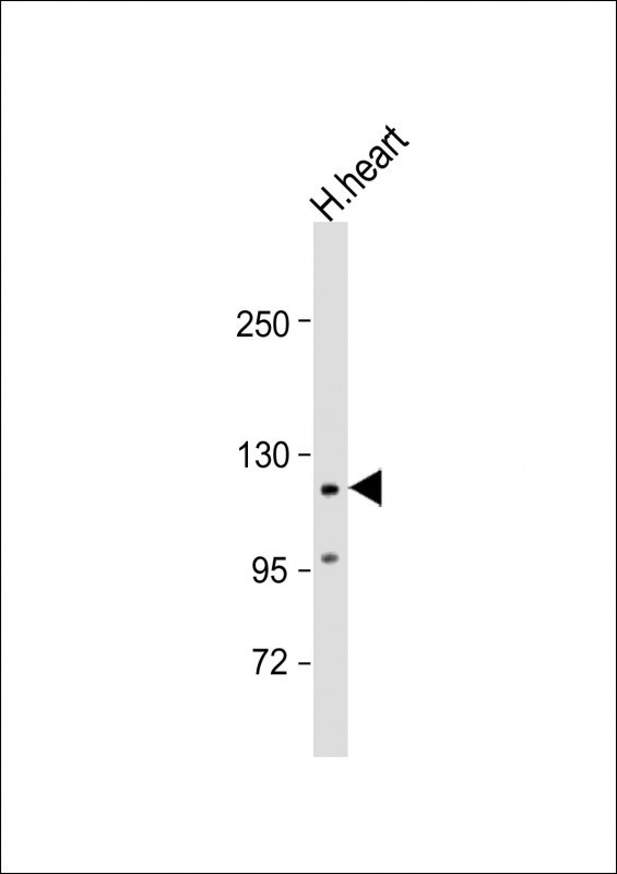 VLDLR Antibody