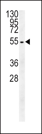 TUBB3 Antibody