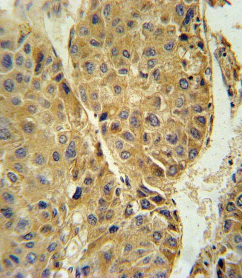 TUBB3 Antibody