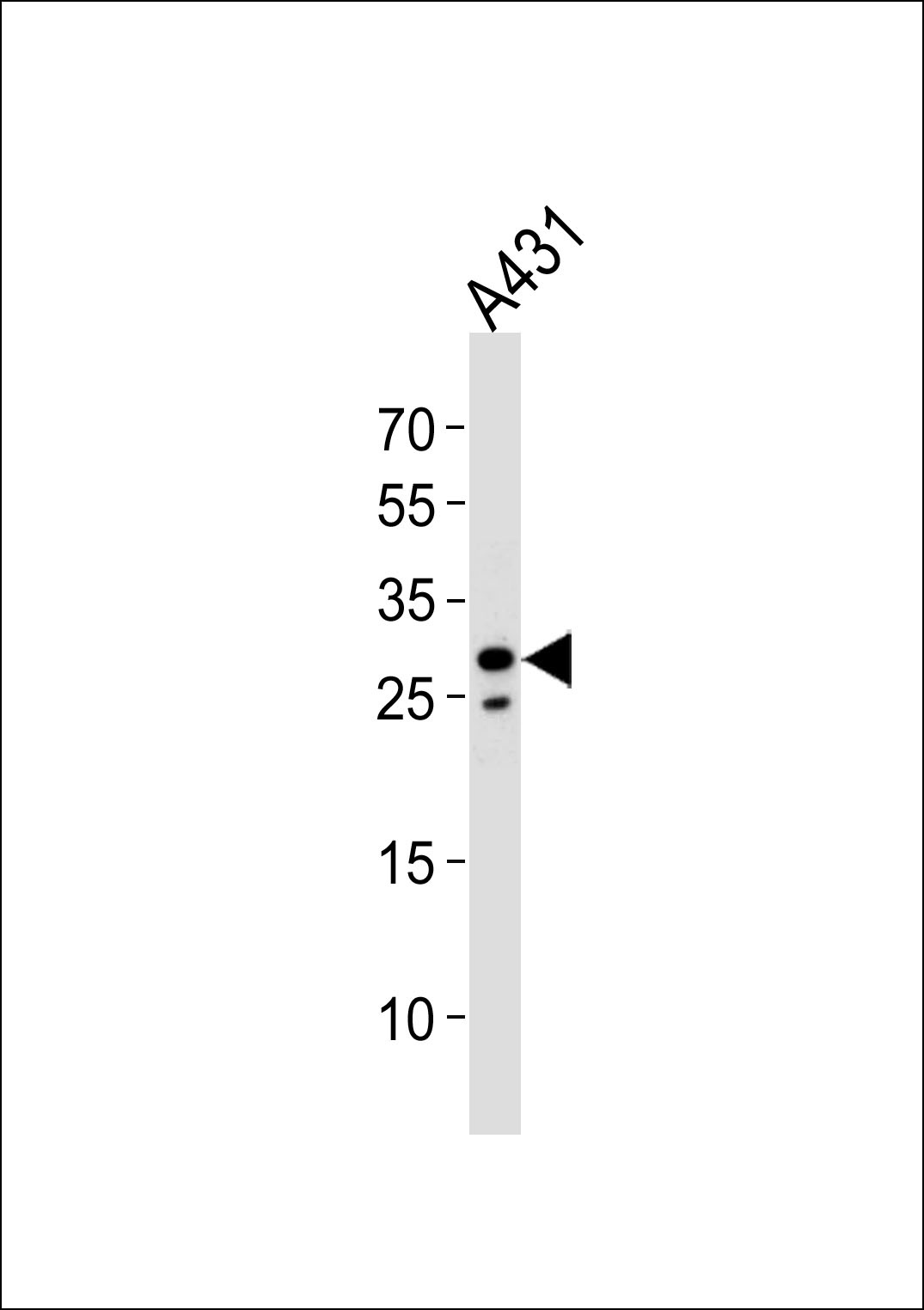 RNF208 Antibody