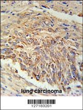 EBPL Antibody