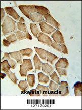 LDHD Antibody