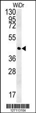 CCYL1 Antibody