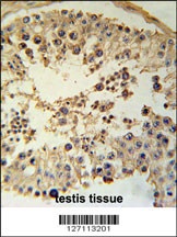 CCYL1 Antibody