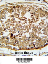 SPAG1 Antibody