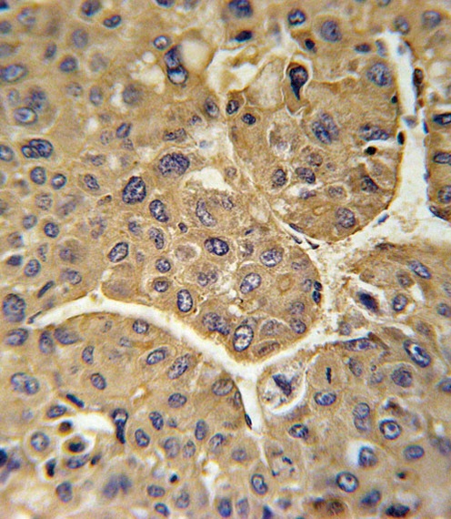 CFHR5 Antibody