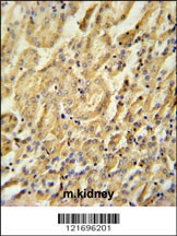 BTBD9 Antibody