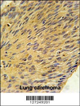 MURC Antibody