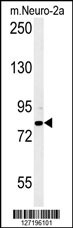 CPEB4 Antibody