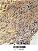 CPEB4 Antibody