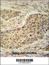 TAF1D Antibody