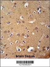 ZDHC2 Antibody