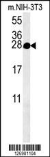 KCT2 Antibody