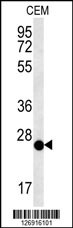 CRISPLD2 Antibody