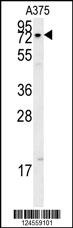 XRCC1 Antibody