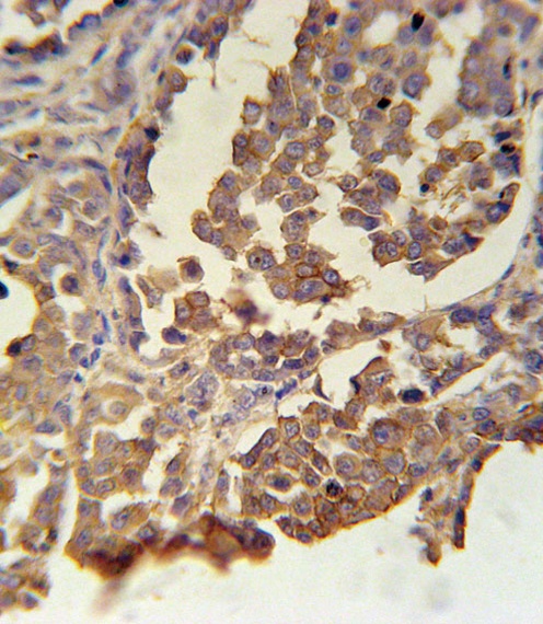 MC2R Antibody